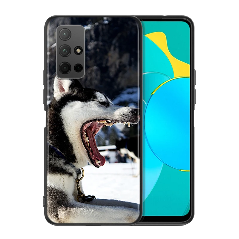 Чехол для Huawei Honor 30 20S Pro 10i 9C 9A 9S 9X 8X 10 9 Lite 8 8A 7A | Мобильные телефоны и аксессуары