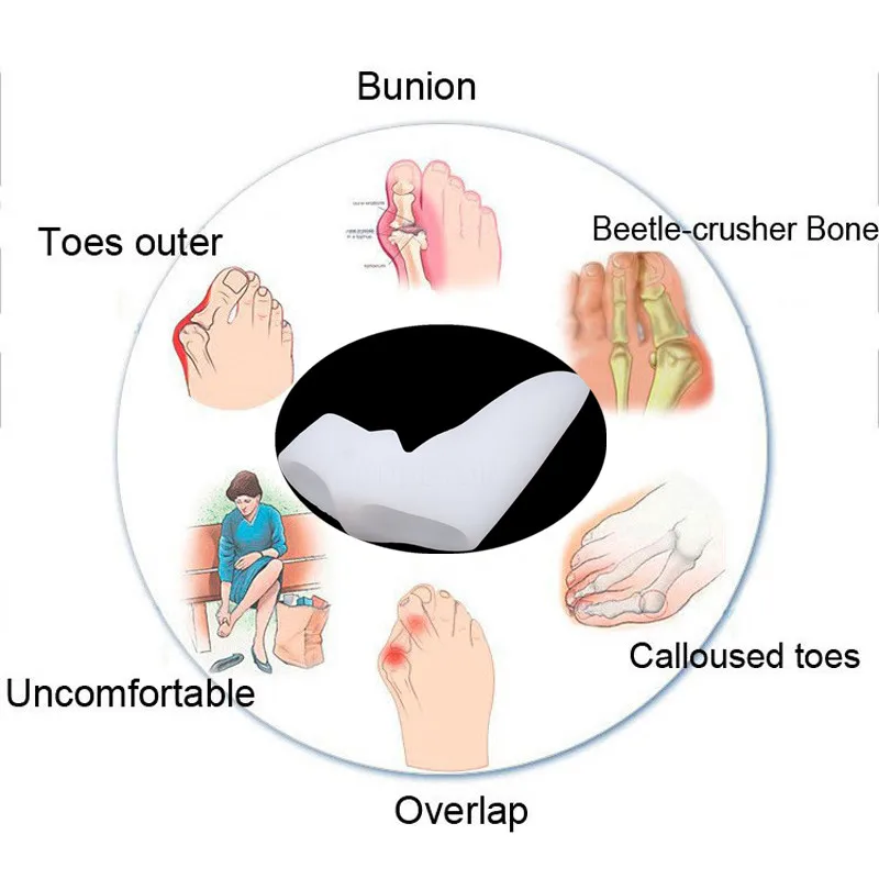Корректор буйона медицинский прибор Hallux стопа с вальгусной деформацией уход за пальцами разделитель большого пальца вальгусный протектор фиксатор, исправление ног инструмент