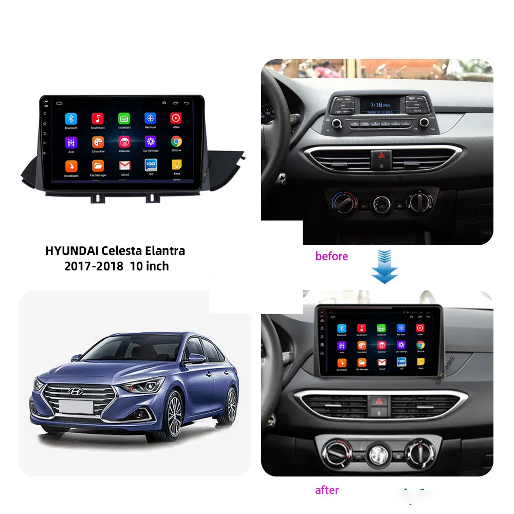 

2 + 16 2din Android 10 4G Wifi RDS DSP автомобильный радиоприемник мультимедийный для Hyundai Celesta Elantra 2017 2018 GPS навигация Авторадио