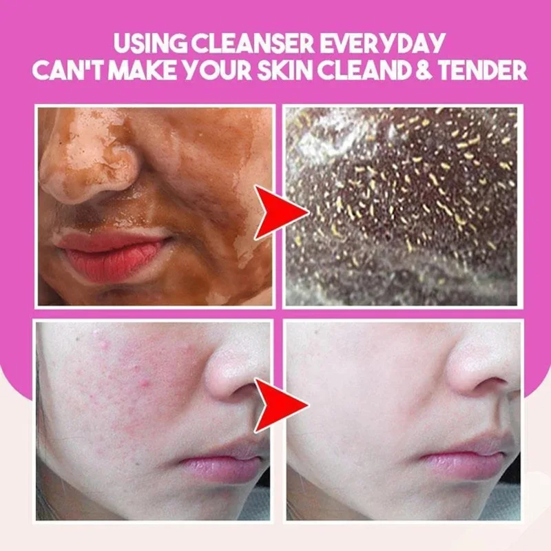 Травяная Омолаживающая отшелушивающая маска с контролем жирности для удаления