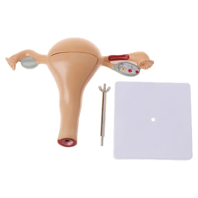 

Human Pathological Uterus Ovary Model Anatomical Anatomy Disease Pathology Lesion For Teaching