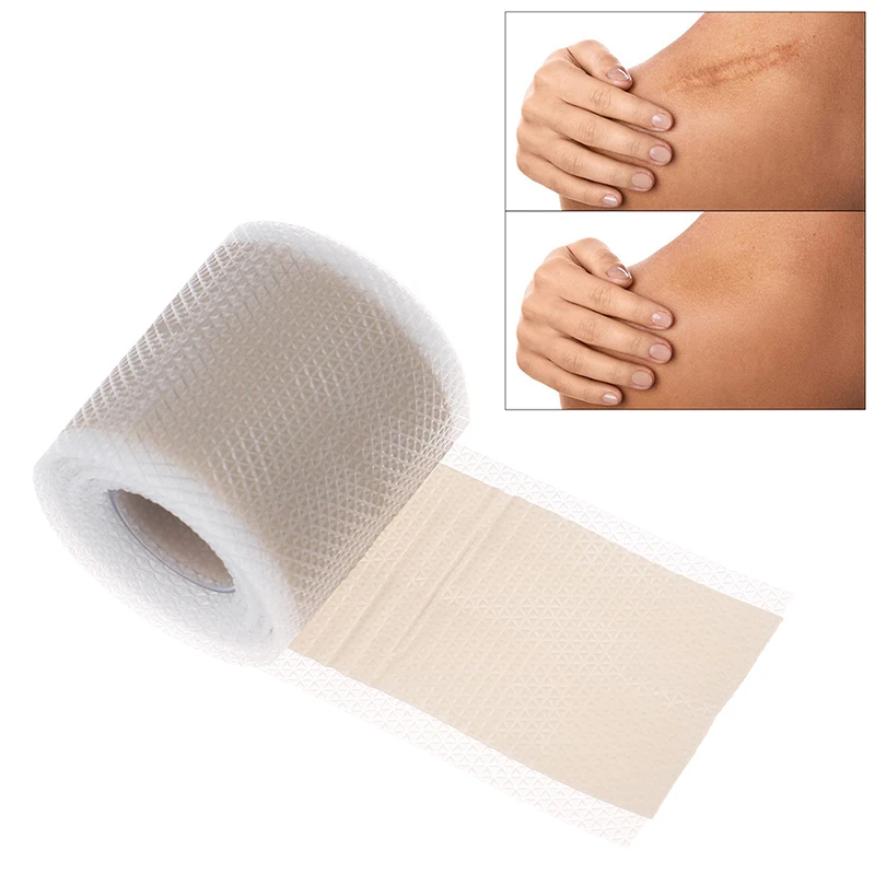 4 м/рулон эффективное удаление шрамов от акне|Брекеты и подставки| |