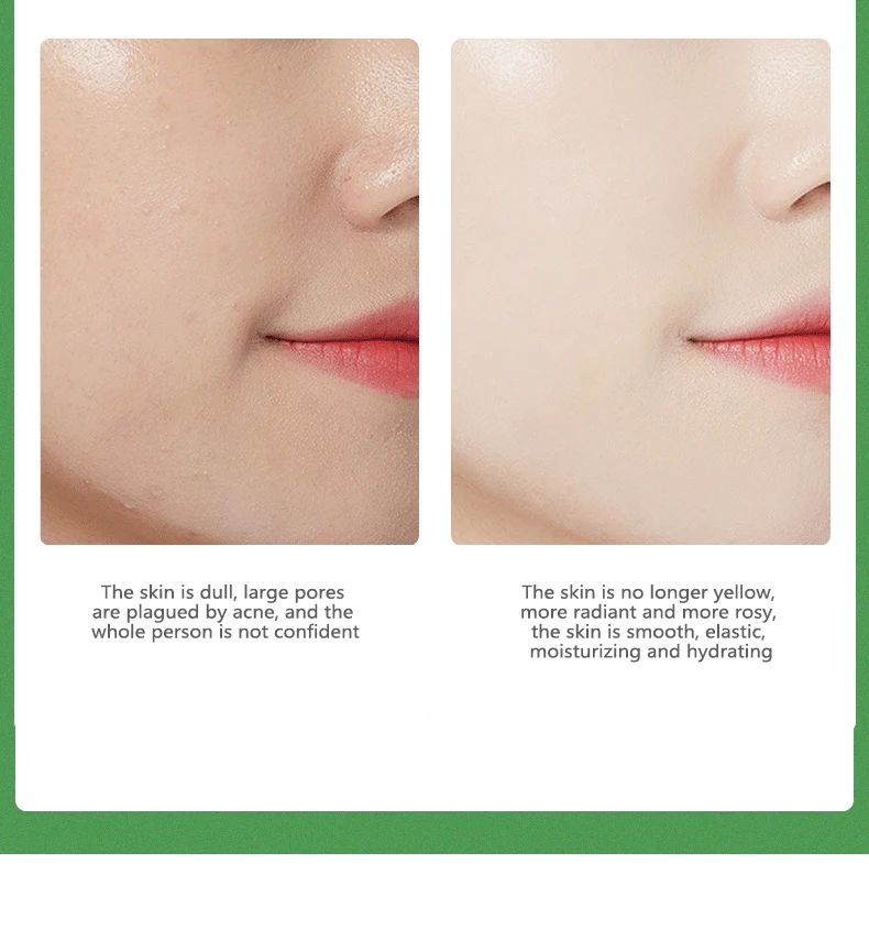 

Avocado Bioaqua Day Face Cream Moisturizers Deep Hydration Crema Para Manchas De La Cara Lifting Facial Firming Korean Skin Care