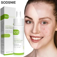 centella oligopeptide acne serum remove acne lighten acne marks relieve redness pimples balance oil secretion facial care 30ml