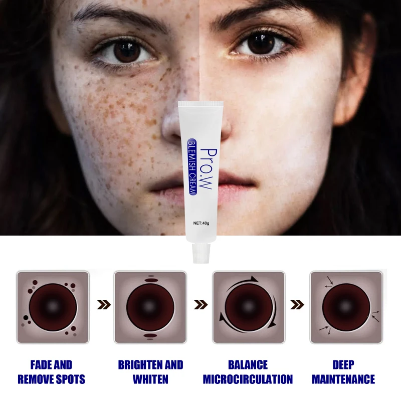 

Intensive Anti-freckle Whitening Cream Moisturizing And Removing Freckles Dark Spots And Chloasma Face Care TSLM1