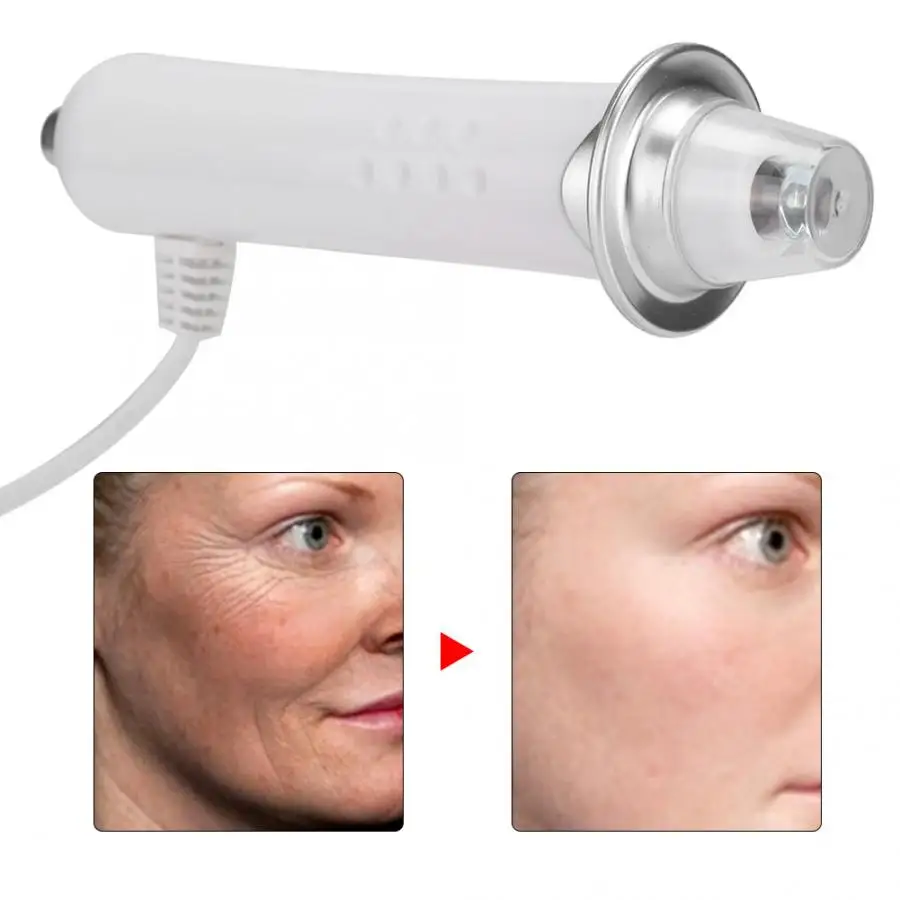 Лазерная машина для удаления волос микро токовая укрепляющая подтяжка кожи