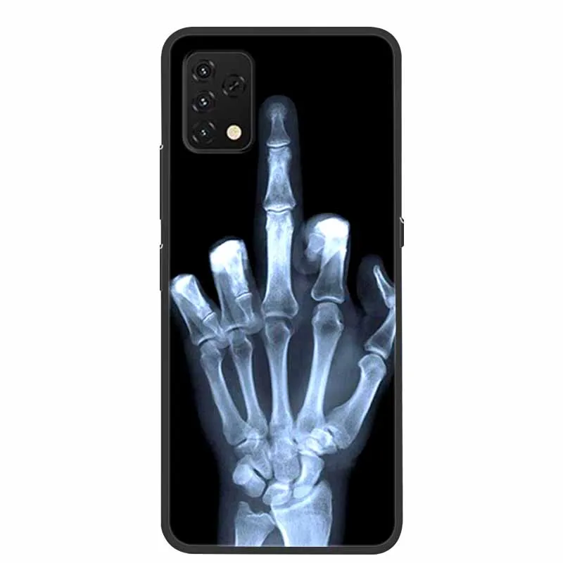 for umidigi a11 case umidigi a11s silicon cover soft bumper phone case for umidigi a11s coque shell umidigia11 a 11s fundas capa free global shipping