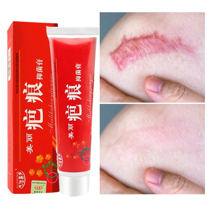 

60g Acne Scar Removal Cream Pimples Stretch Marks Face Gel Remove Acne Smoothing Whitening Moisturizing Body Skin Care BB cream