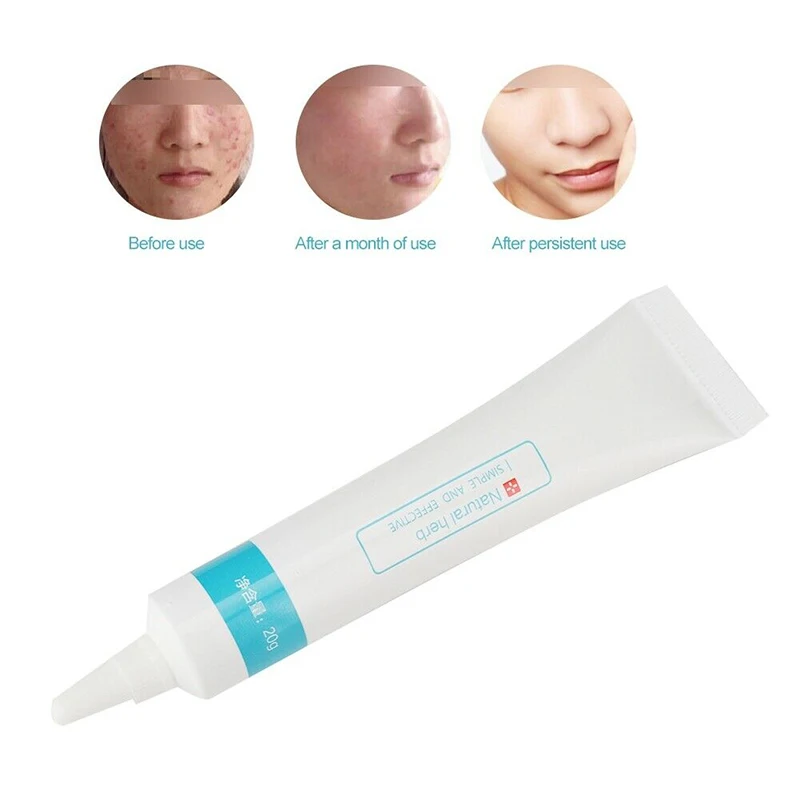 Новейший 20 г Крем для удаления шрамов увлажняющий крем мазь восстановления