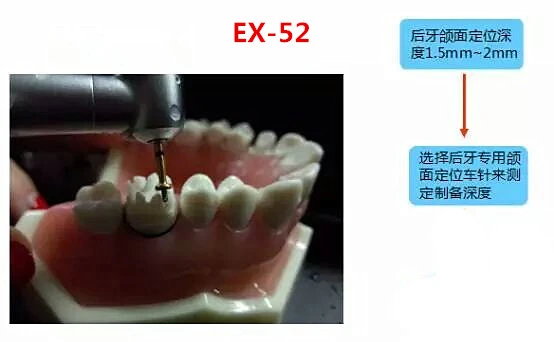 10 шт. фарфоровый шпон для подготовки зубов|Стомотологические сверла и щетки| |