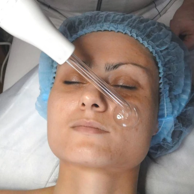 Высокочастотный электротерапевтический лица машина Электрический Сумерки