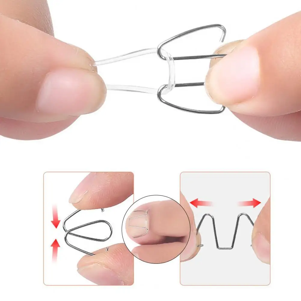 

1 Набор железная вросшие ногти закрепитель для ногтей на ногах вросшие ногти для ног "францзуский маникюр" корректор анти-ржавчины, чтобы по...