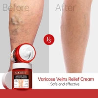 80g feet varicose veins cream treatment relieve dilated capillaries remove phlebitis spider leg veins varicose body cream beauty