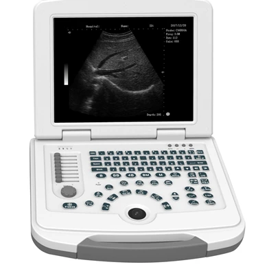 

BT-UD500 Medical B/W Ультразвуковая портативная ультразвуковая система, цена на продажу