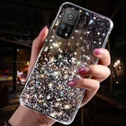 Чехол для Redmi Note 11 Pro, блестящий чехол для Xiaomi Redmi Note 11, 10, 10S, Note11, 11Pro Plus, Note10, 10Pro, силиконовые чехлы для телефонов