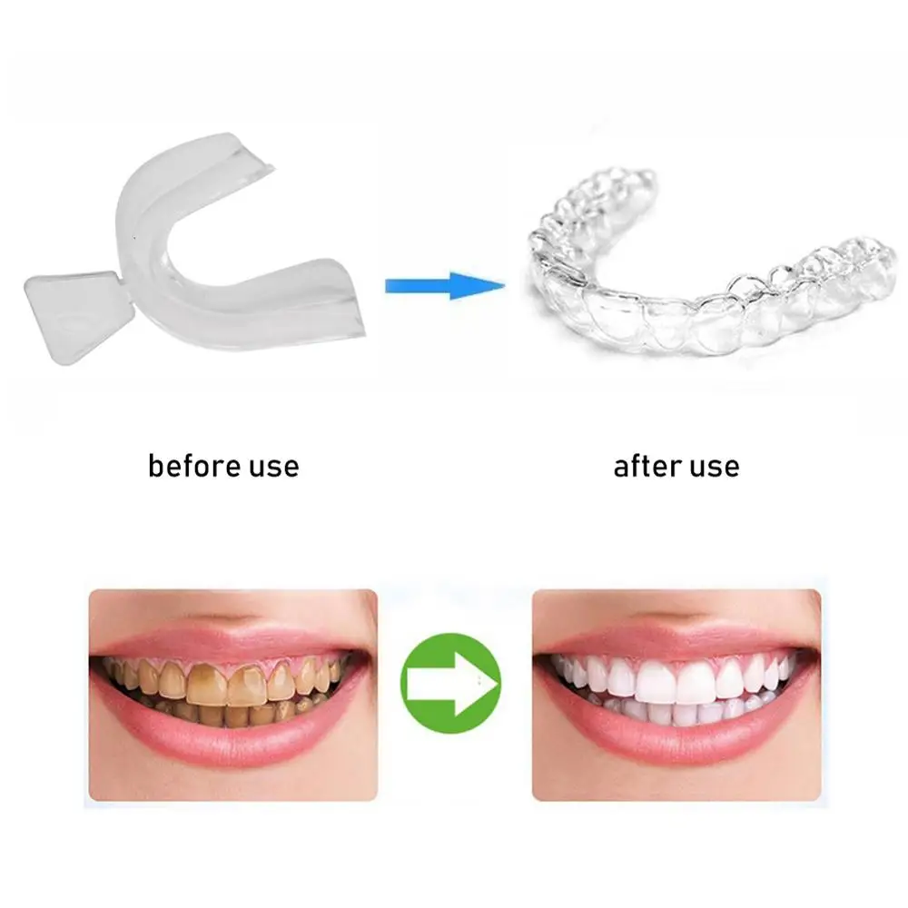 1 пара стоматологических материалов Отбеливание зубов Стоматологическая