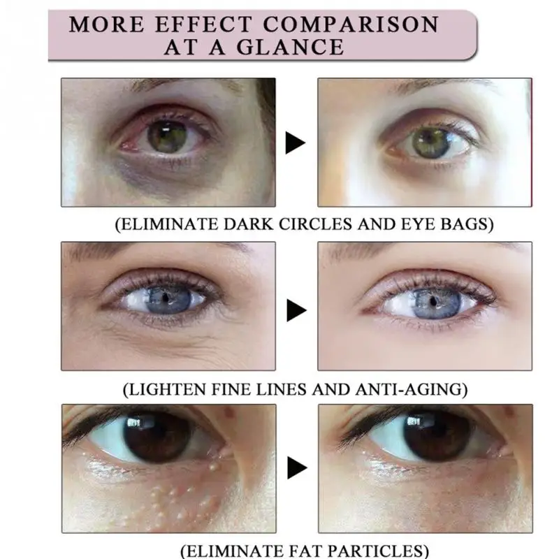 Probiotic крем для глаз Съемный Травяной Уход кожи портативный Увлажняющий Темный