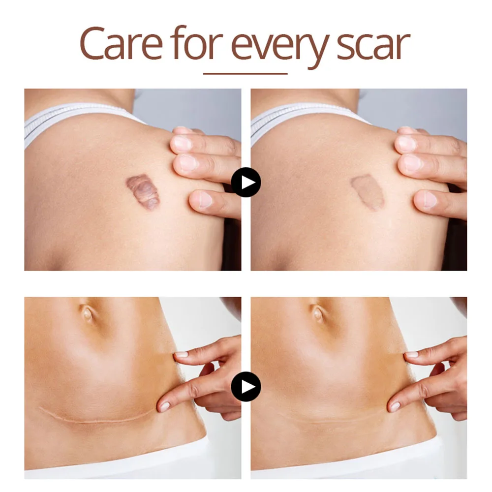 

Skin Care
