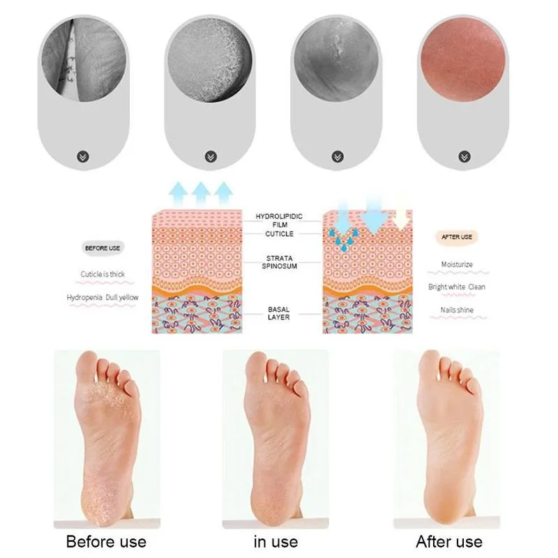 

Breathable Socks Silicone Foot Care Tool Feet Protector Relief Moisturize Dead Crack Removal Sock Pain Prevention Skin Hole C7E9