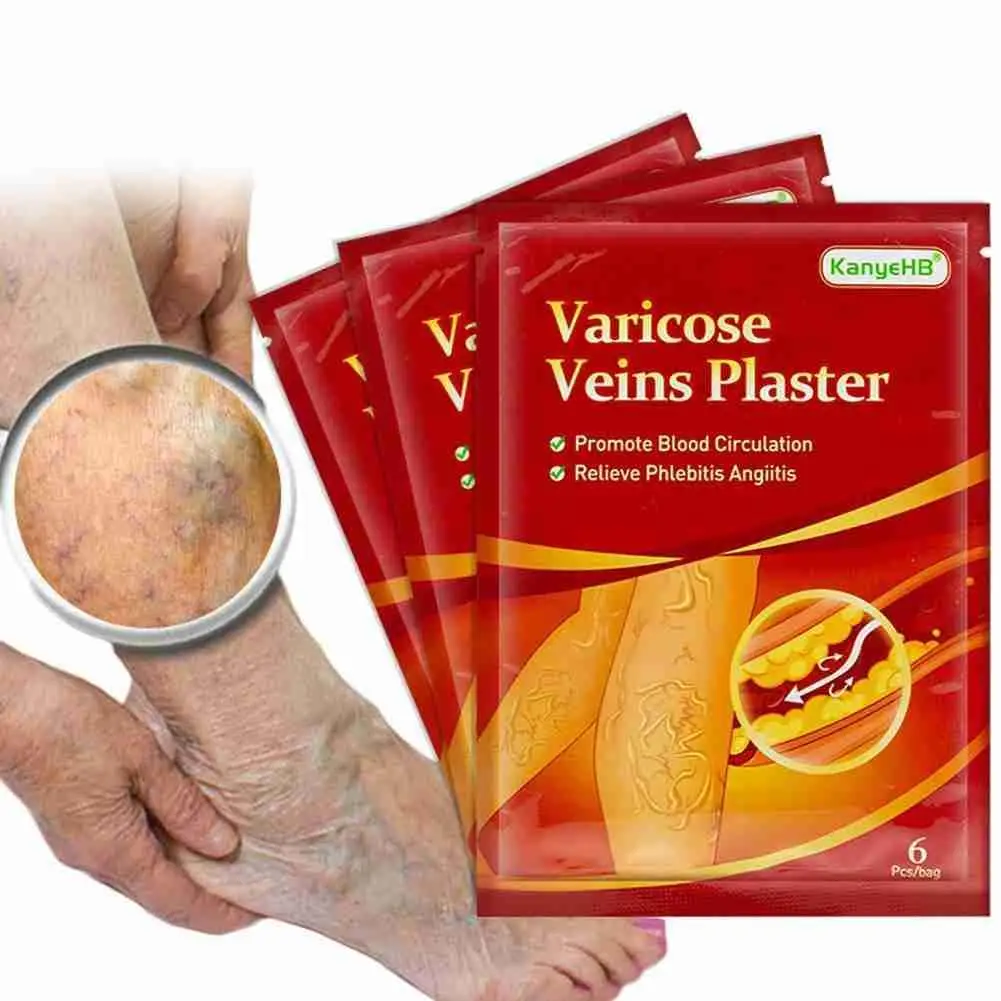 

6pcs Varicose Vein Patches Varicose Veins Vasculitis Phlebitis Spider Cream Varicosity Angiitis Removal Herbal Medical Plaster