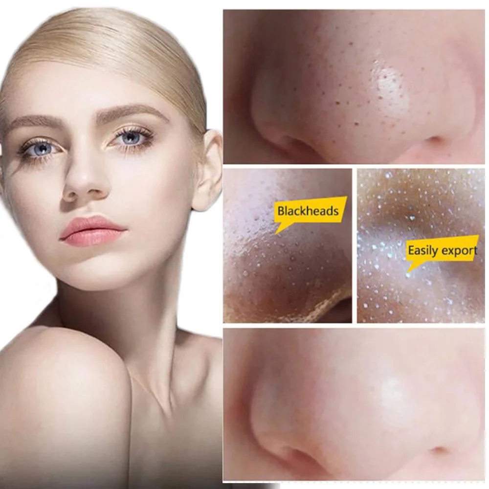 1 коробка Отшелушивающий алоэ акне угрей усадочный пор пластырь для отбеливания