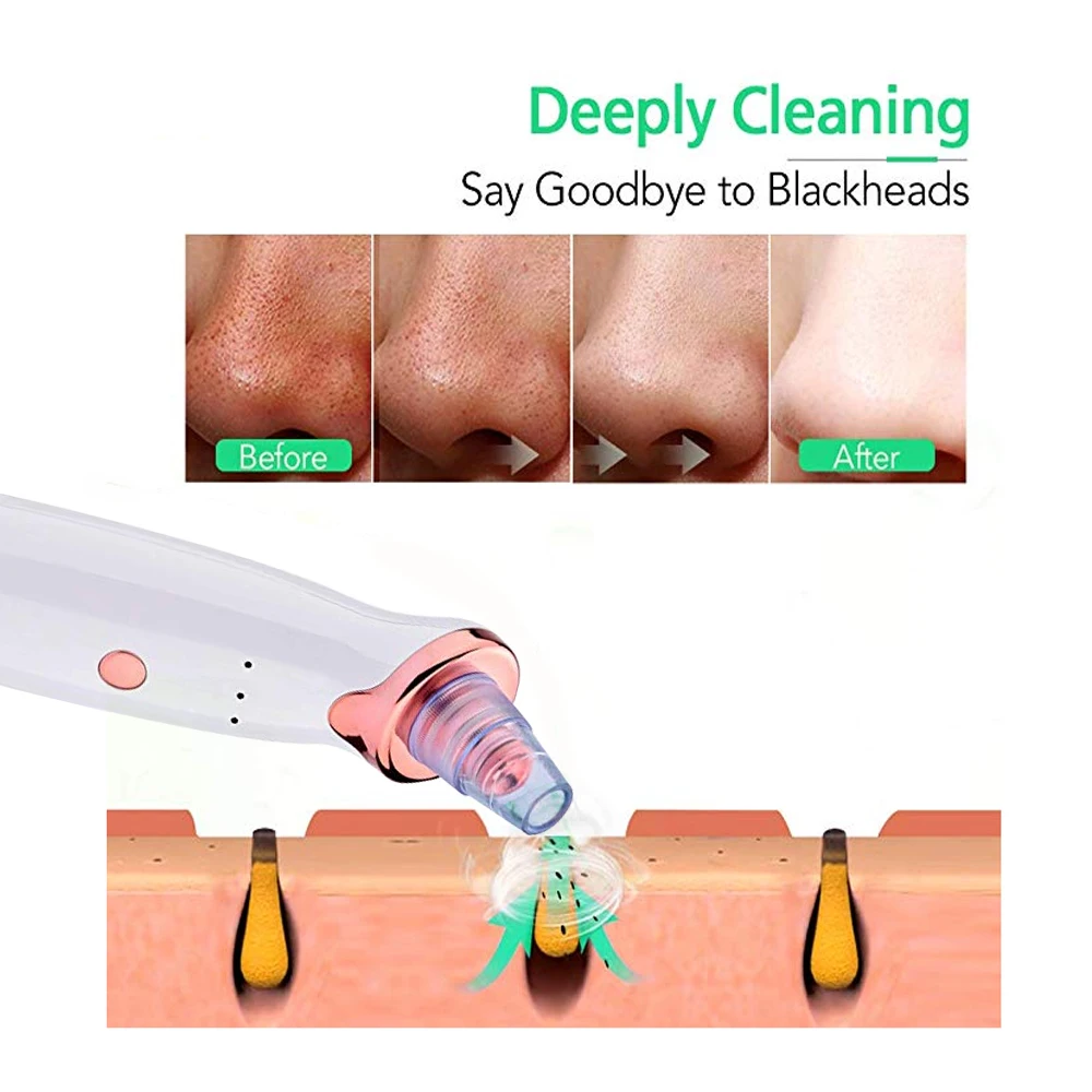 Для удаления угрей пылесос в черный горошек для маленьких девочек чистки лица