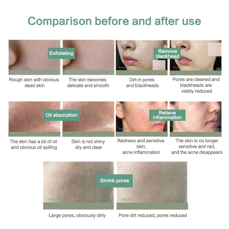 Geoskincare Очищающая грязь для лица вулканическая Грязь Удаление пор укрепляющий