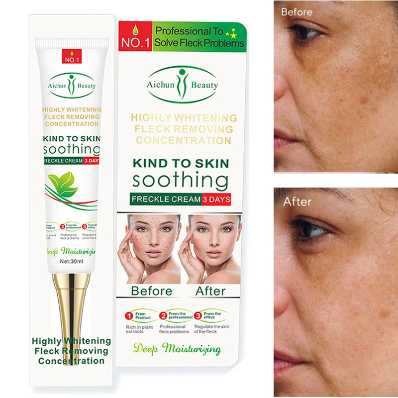 

Эффективное быстрое средство 30 г для удаления мелазмы, пятен акне, пигмента меланина, темных пятен, отбеливающий увлажняющий крем для ухода ...