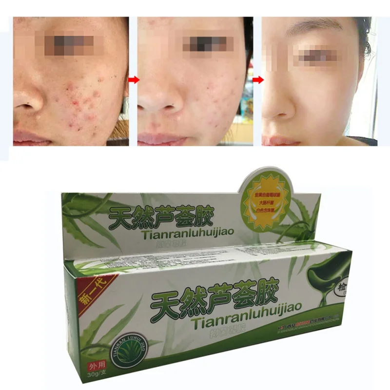 Увлажняющий гель с алоэ вера 30 мл | Красота и здоровье