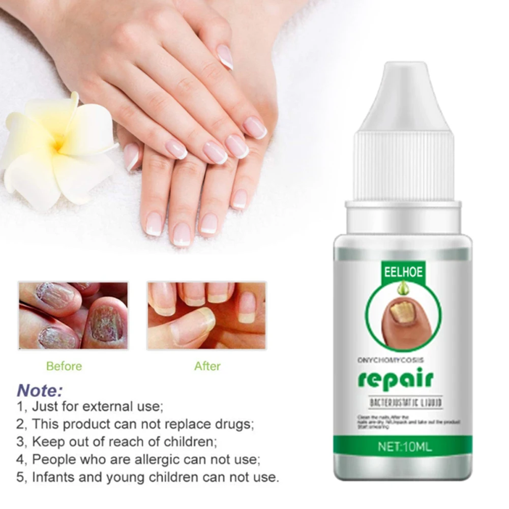Сыворотка для лечения грибка ногтей от и восстановление способствует новому