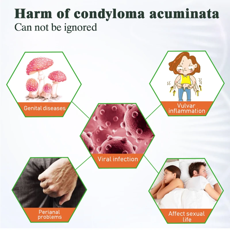 2pcs Wart Remover Ointment Genital Herpes Vulva Condyloma Acuminatum Skin Tag Antibacterial Treatment Cream A658 | Красота и здоровье