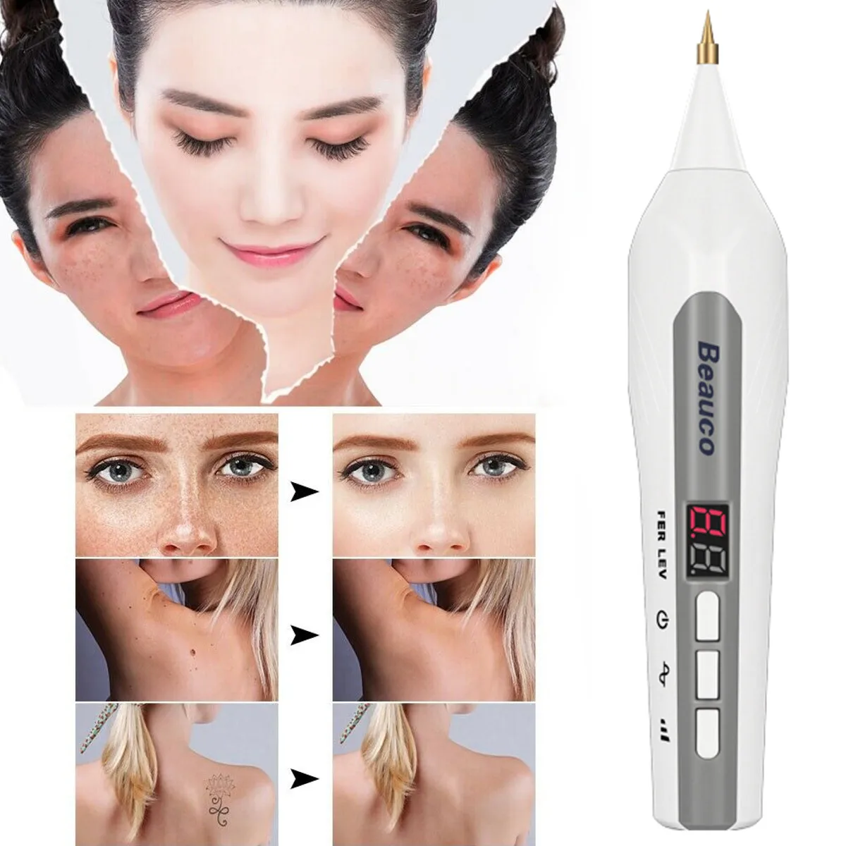Fibroblast плазменная ручка для лица, для подтяжки век, для удаления морщин, для удаления пятен, Plasmapen, для подтяжки кожи, Usb, 4 файла, регулируемая, новинка