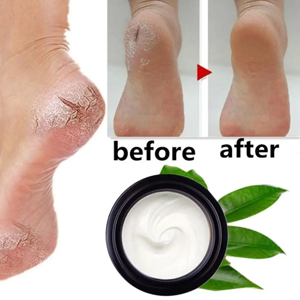 

Horse Oil Feet Cream Anti Dry Crack Repair Heel Feet Cream Foot Exfoliating Cracked Creams Care Hand Balm Heel Foot D0K8