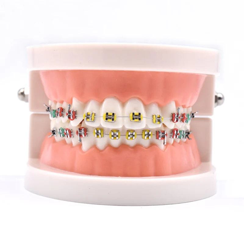 Стоматологическая модель кариеса обучающая зуба уход за зубами для обучения