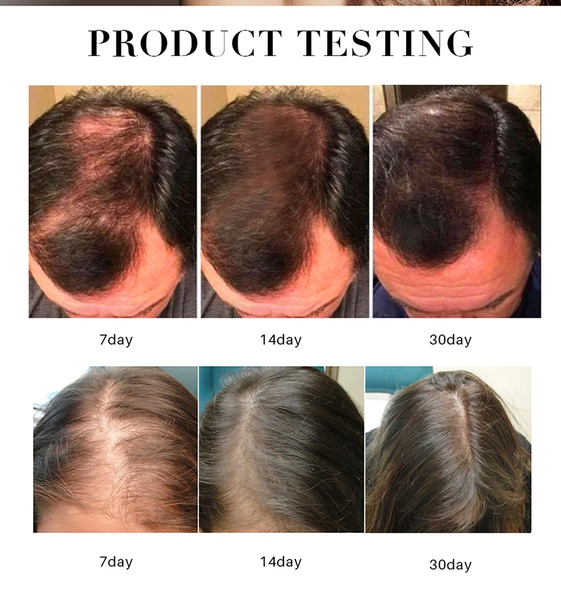Effective 120ML Hair Growth nutrition Essence Oil Loss Treatment for Men Women Thailand effective hair lotion | Красота и здоровье