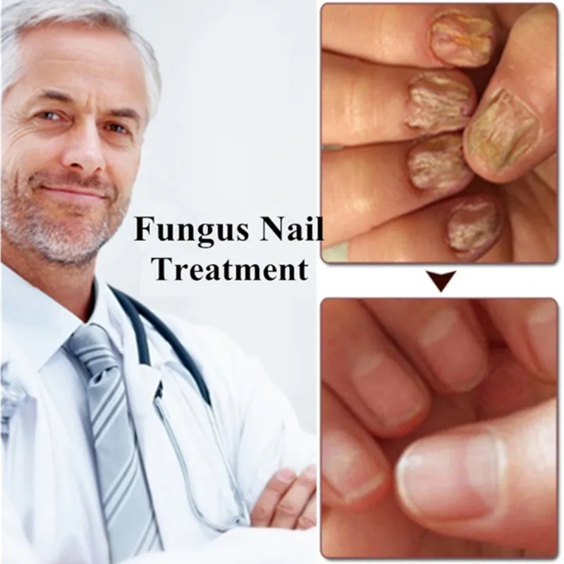 10 мл жидкое антибактериальное очищающее средство для ухода за кожей ногтями