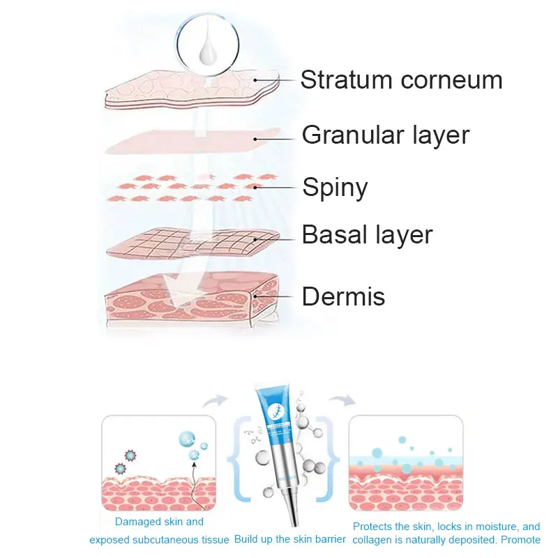 

Scarless Cream Scar Treatment Ointment Reduce the Appearance of Old and New Scars M2
