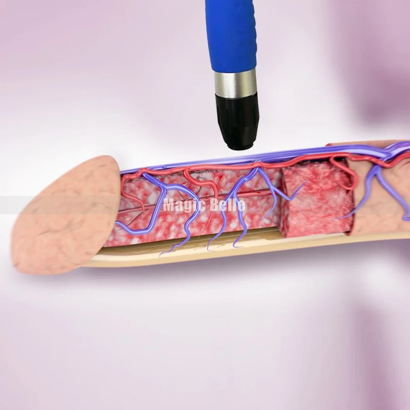 

2021 Extracorporeal Shock Wave Therapy Equipment Back Pain Relieve Pain ED Treatment for Clinic