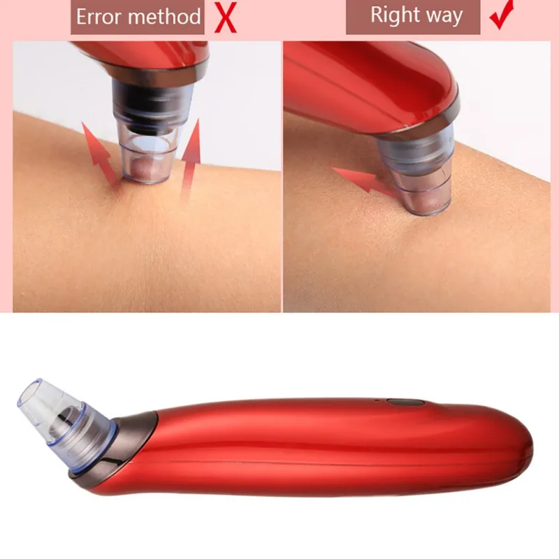 

Electric Acne Remover Point Noir Blackhead Vacuum Extractor Tool Nose Face Deep Cleansing Skin Care Machine Beauty ToolS