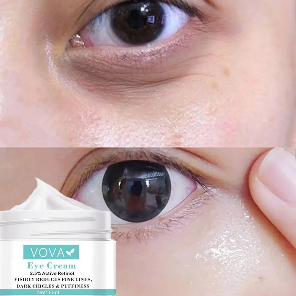30ml Retinol Cream Instant Remove Eye Bags Anti Puffiness Dark Circles Fades Wrinkles Aging Care |