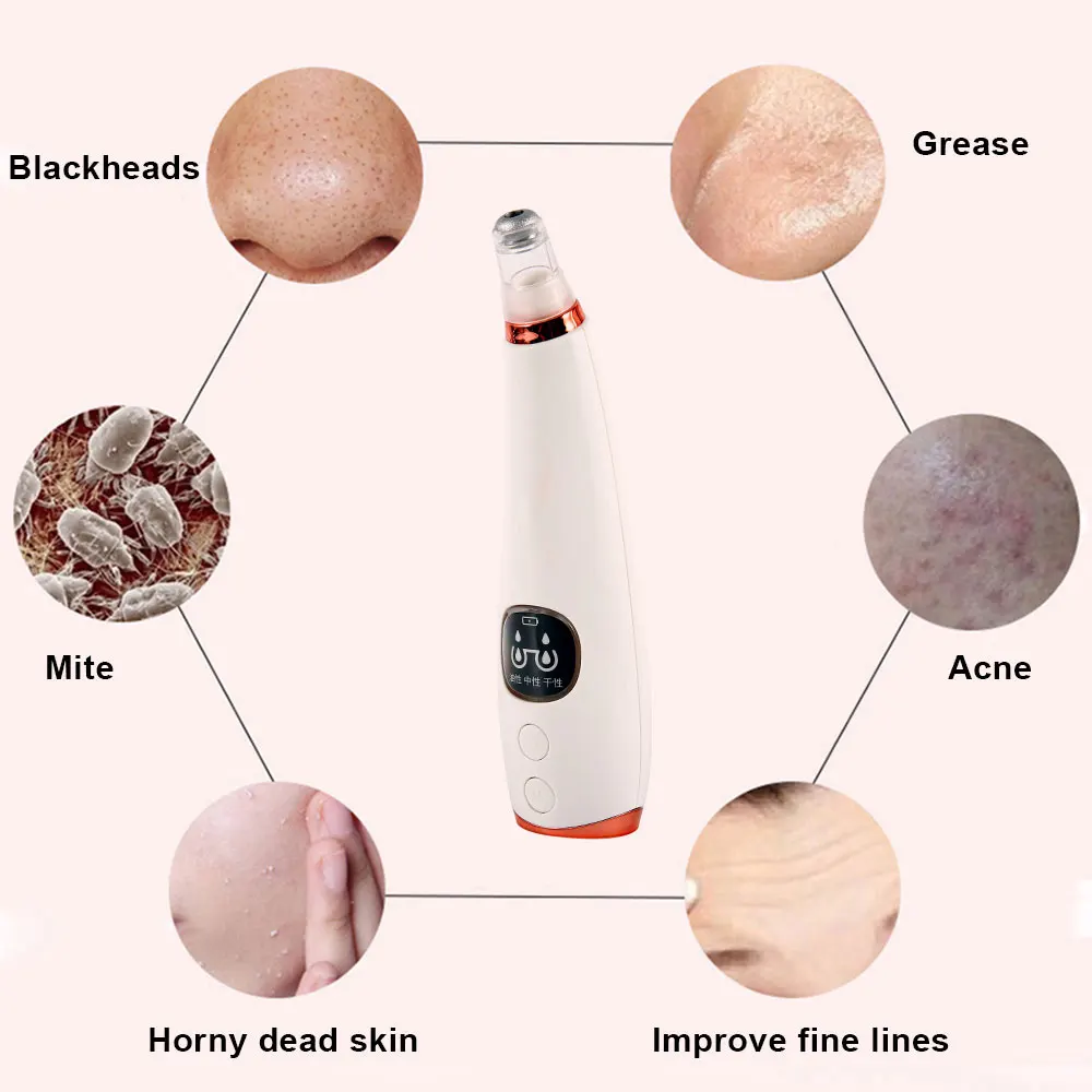 Горячий угрей уход за кожей пор вакуумный акне Удаление прыщей всасывающий