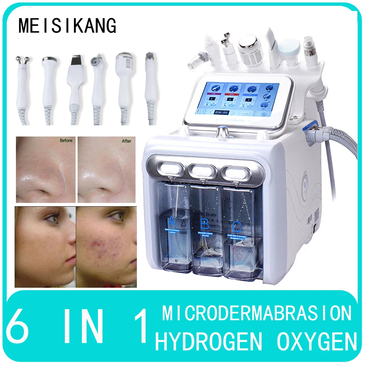 

MEISIKANG 6 in 1 Rf Hydro Microdermabrasion Home Use Water Dermabrasion Multifunction For Facials Deep Cleansing Lifting Machine