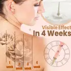 Перманентный крем для удаления татуировок без необходимости снятия боли Максимальная прочность