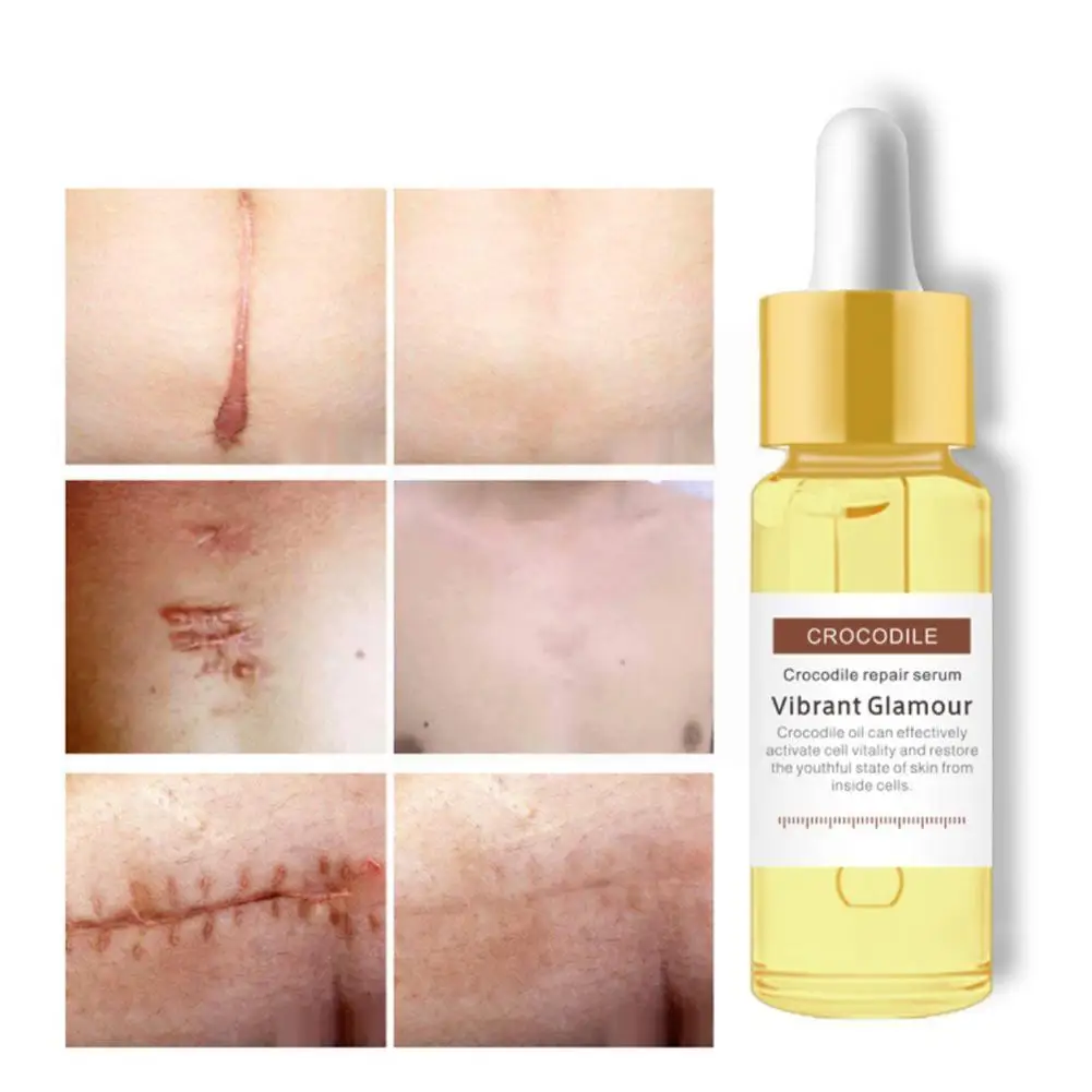 

Scar Repair Cream Repairing Removing Burn Scars Promote Regeneration Skin Care Cell Elasticity Enhance R1W5