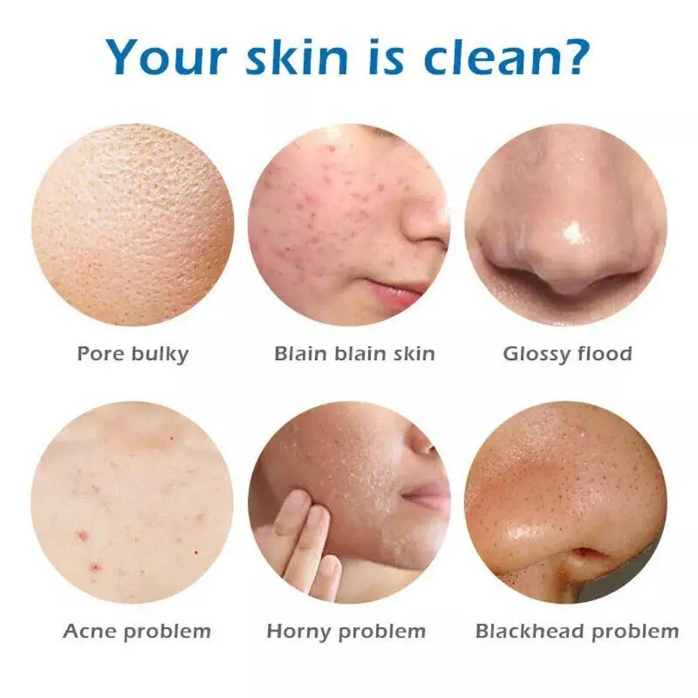 

100g Ginger Essential Oil Soap Skin Care Deep Cleansing Moisturizing Acne Treatment Care Oil-control Whitening Skin Soap W2Y9