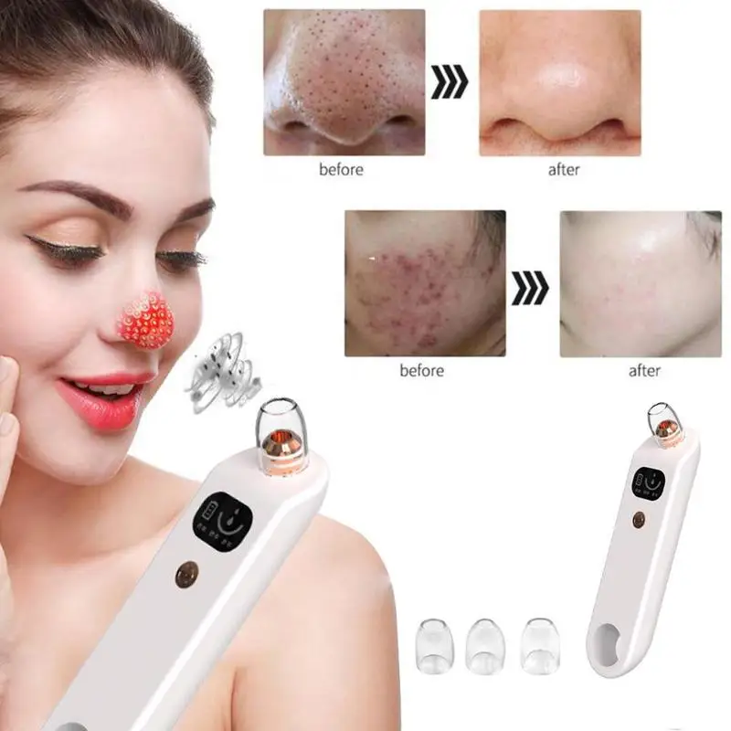Вакуумный аппарат для очистки пор от угрей вакуумный экстрактор инструмент