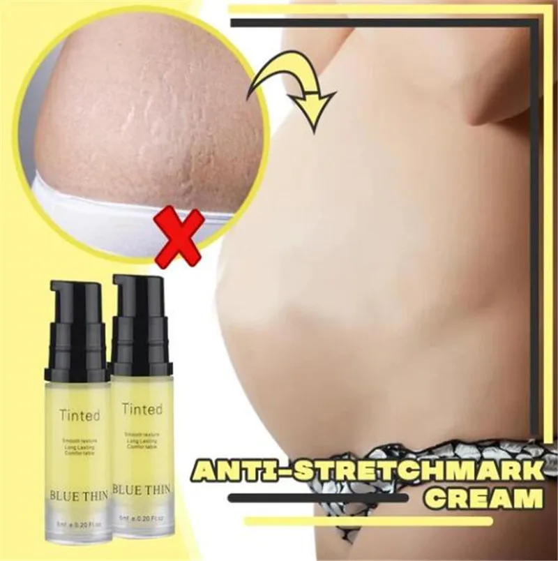 Антирастягивающий крем средство для удаления драгоценных растяжек шрамов