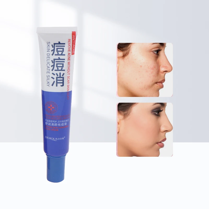 

30g Acne Treatment Blackhead Remove Anti Acne Repair Cream Oil Control Shrink Pores Scar Remove Face Skin Care Whitening Cream