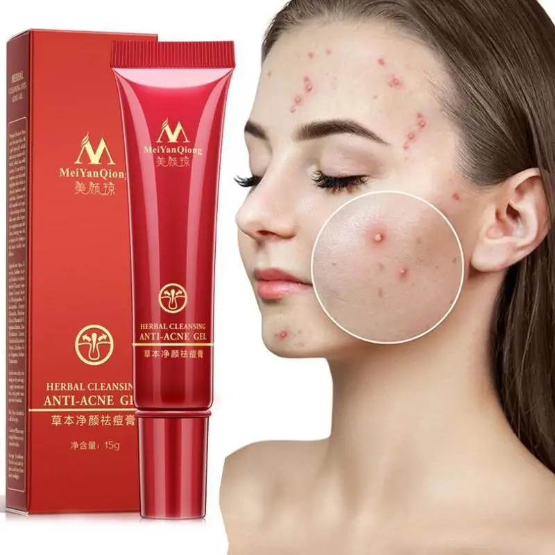 

1 шт., отбеливающий увлажняющий гель для лица, против акне