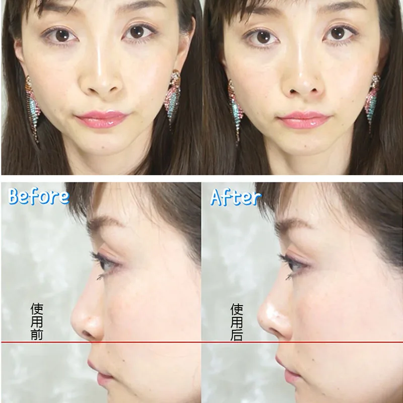 6 шт./компл. 3 размера красота поднятие носа мостик формирователь массажный